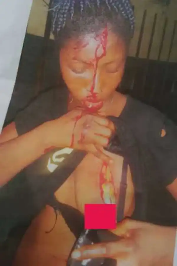 Nursing Mother Slashes Her Husband